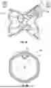 Fig. 12 - INTERATRIAL SHUNT HAVING PHYSIOLOGIC SENSOR