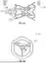 Fig. 15 - INTERATRIAL SHUNT HAVING PHYSIOLOGIC SENSOR