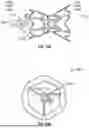 Fig. 17 - INTERATRIAL SHUNT HAVING PHYSIOLOGIC SENSOR