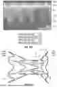 Fig. 21 - INTERATRIAL SHUNT HAVING PHYSIOLOGIC SENSOR