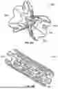 Fig. 33 - INTERATRIAL SHUNT HAVING PHYSIOLOGIC SENSOR
