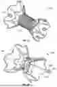Fig. 34 - INTERATRIAL SHUNT HAVING PHYSIOLOGIC SENSOR
