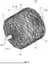 Fig. 02 - Vascular Occlusion Device