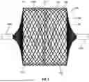 Fig. 03 - Vascular Occlusion Device