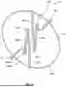 Fig. 06 - Vascular Occlusion Device