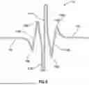 Fig. 07 - Vascular Occlusion Device