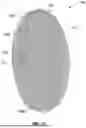 Fig. 11 - Vascular Occlusion Device