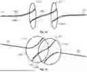 Fig. 16 - Vascular Occlusion Device