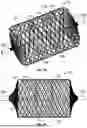 Fig. 17 - Vascular Occlusion Device