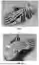 Fig. 02 - POSITIONING AND CUTTING GUIDES AND ASSOCIATED METHODS FOR ORTHOPEDIC PROCEDURES