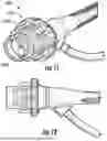 Fig. 09 - SKIN TREATMENT SYSTEM WITH ADJUSTABLE HEIGHT WAND