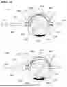 Fig. 11 - ASPIRATION SYSTEMS, DEVICES AND METHODS FOR TREATING ISCHEMIC STROKE