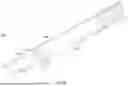 Fig. 05 - GUIDEWIRELESS SHOCK WAVE CATHETERS
