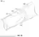 Fig. 06 - GUIDEWIRELESS SHOCK WAVE CATHETERS