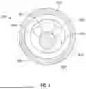 Fig. 07 - GUIDEWIRELESS SHOCK WAVE CATHETERS