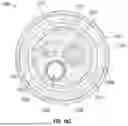 Fig. 17 - GUIDEWIRELESS SHOCK WAVE CATHETERS