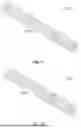 Fig. 18 - GUIDEWIRELESS SHOCK WAVE CATHETERS
