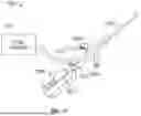 Fig. 19 - GUIDEWIRELESS SHOCK WAVE CATHETERS