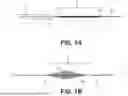 Fig. 02 - THROMBUS ASPIRATION CONTROL SYSTEMS AND RELATED METHODS FOR CONTROLLING BLOOD LOSS