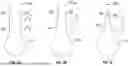 Fig. 04 - ARTICULATING DEBRIDER BLADE TIP AND HANDPIECE CONTROL