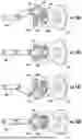 Fig. 20 - ROTARY OSCILLATING AND RECIPROCATING SURGICAL TOOL