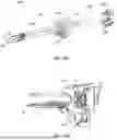 Fig. 20 - TRANSVAGINAL ACCESS APPARATUS AND METHODS