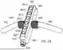 Fig. 29 - EXTERNAL FIXATOR ASSEMBLY