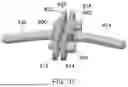 Fig. 35 - EXTERNAL FIXATOR ASSEMBLY