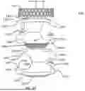 Fig. 47 - EXTERNAL FIXATOR ASSEMBLY