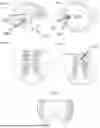 Fig. 05 - ROD REDUCTION ASSEMBLIES AND RELATED METHODS
