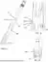 Fig. 06 - ROD REDUCTION ASSEMBLIES AND RELATED METHODS