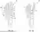 Fig. 03 - ORTHOPEDIC SCREW AND DRIVER SYSTEM FOR MINIMALLY INVASIVE METATARSAL CORRECTION PROCEDURE