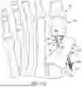 Fig. 17 - ORTHOPEDIC SCREW AND DRIVER SYSTEM FOR MINIMALLY INVASIVE METATARSAL CORRECTION PROCEDURE