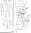 Fig. 18 - ORTHOPEDIC SCREW AND DRIVER SYSTEM FOR MINIMALLY INVASIVE METATARSAL CORRECTION PROCEDURE