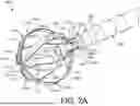 Fig. 03 - MAPPING AND ABLATING CATHETERS USING FLEXIBLE CIRCUITS