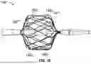 Fig. 19 - SYSTEM AND METHODS FOR APPLYING ENERGY FOR CARDIAC SYMPATHETIC DENERVATION