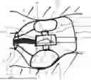 Fig. 01 - MEDICAL ENDODEVICE