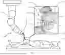Fig. 02 - MEDICAL ENDODEVICE