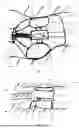 Fig. 03 - MEDICAL ENDODEVICE