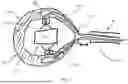 Fig. 04 - MEDICAL ENDODEVICE