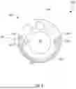 Fig. 09 - EMBEDDED LASER FIBER FOR ASPIRATED STONE ABLATION