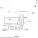 Fig. 10 - EMBEDDED LASER FIBER FOR ASPIRATED STONE ABLATION