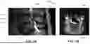 Fig. 06 - DEVICES, METHODS, AND SYSTEMS FOR ASSESSING SUITABILITY OF SPINAL IMPLANTS