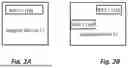 Fig. 03 - MEDICAL DEVICE NAVIGATION TRACKING