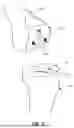 Fig. 03 - A SURGICAL ROBOTIC SYSTEM FOR EXECUTING A BONE IMPLANT SURGICAL PLAN