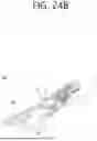 Fig. 32 - APPARATUS FOR DRIVING SURGICAL ROBOT SYSTEM AND METHOD THEREOF