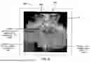 Fig. 06 - IMAGING AND DISPLAY SYSTEM FOR GUIDING MEDICAL INTERVENTIONS