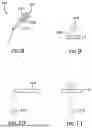 Fig. 09 - IMAGING AND DISPLAY SYSTEM FOR GUIDING MEDICAL INTERVENTIONS