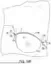 Fig. 32 - FLEXIBLE SURGICAL STENCILS AND RELATED METHODS