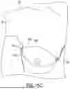 Fig. 33 - FLEXIBLE SURGICAL STENCILS AND RELATED METHODS